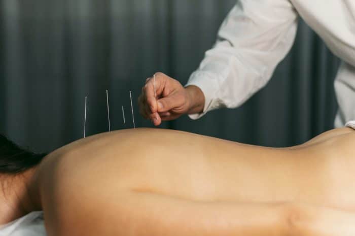 Akupunktura: Starożytna Sztuka Leczenia Oparta na Energetyce Ciała